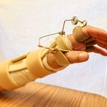 Outrigger-Splint-4_edited