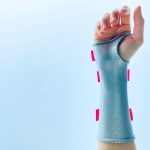 Wrist-splint-front